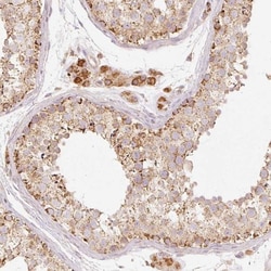 PSENEN/PEN2 Antibody, Novus Biologicals 25 &mu;L; Unlabeled:Antibodies,
